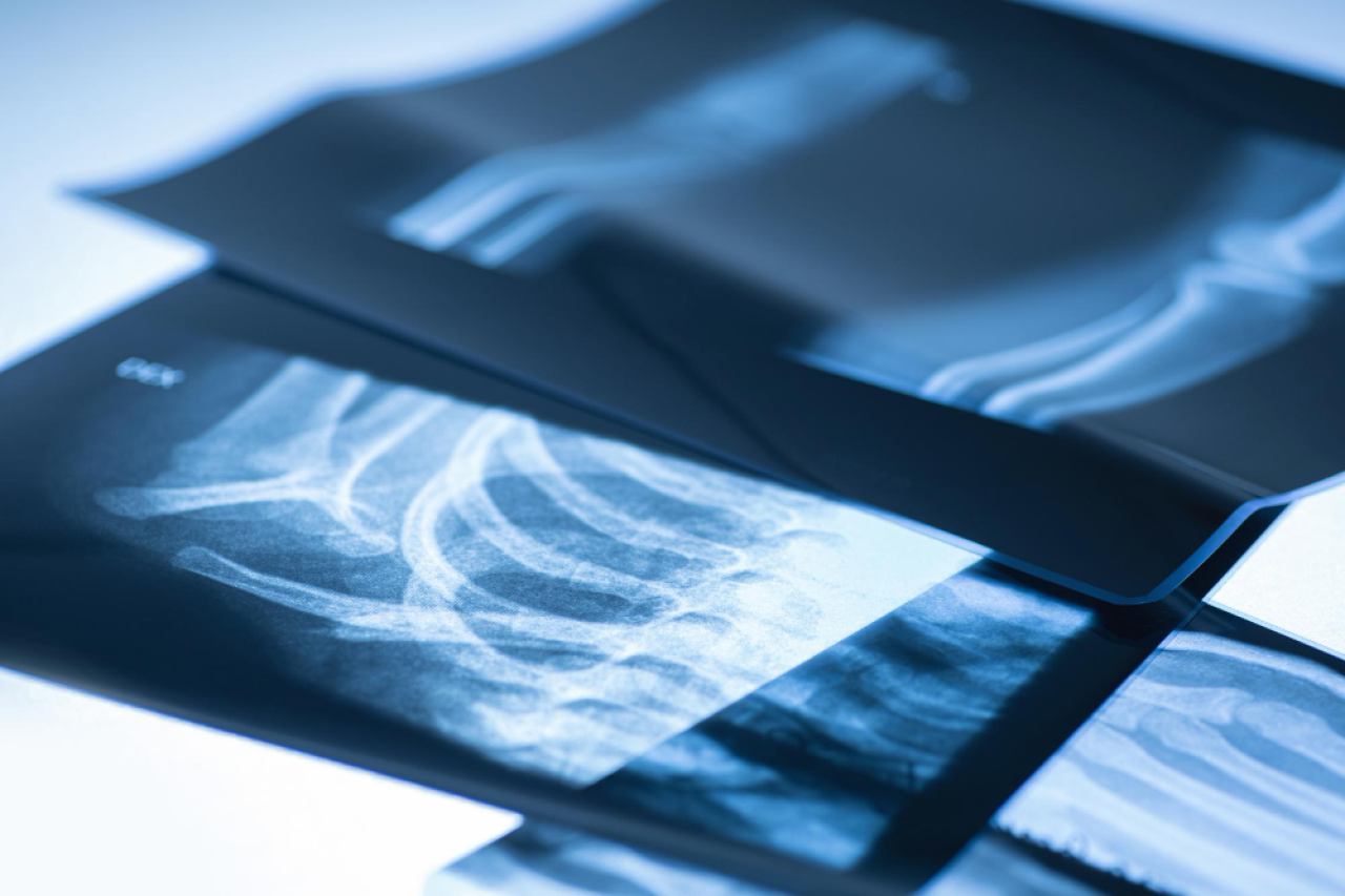 RADIOGRAPHY X-RAY IMAGING