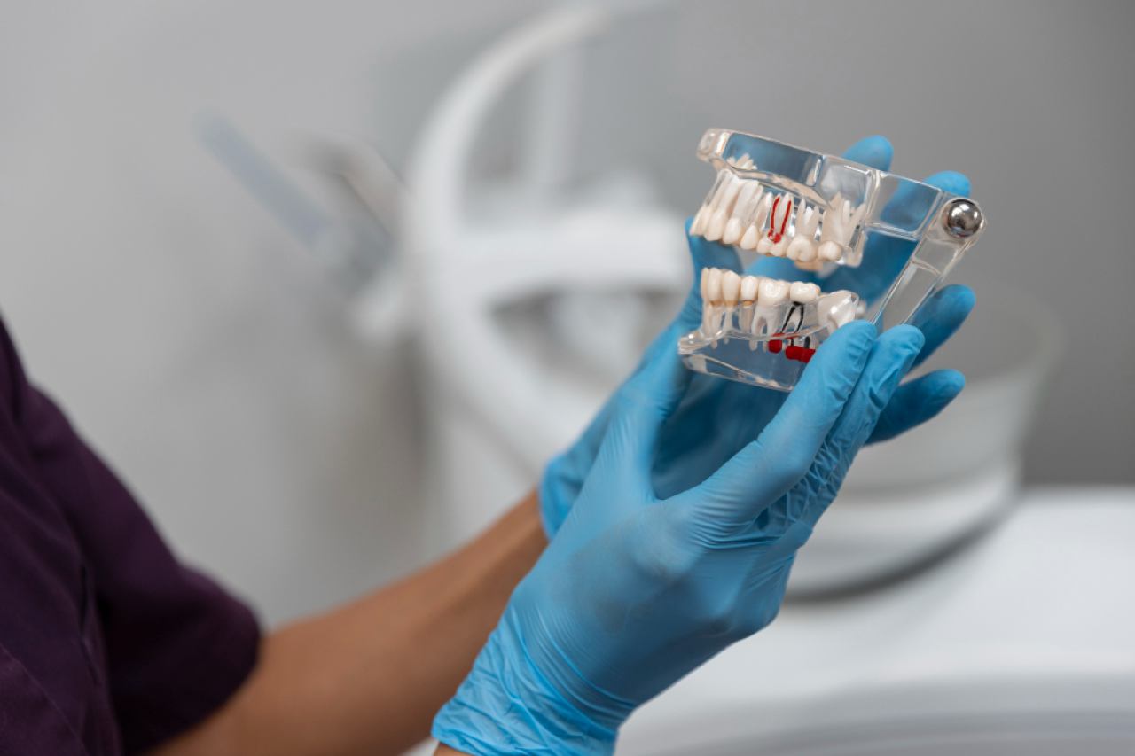 DENTALNI IMPLANTATI