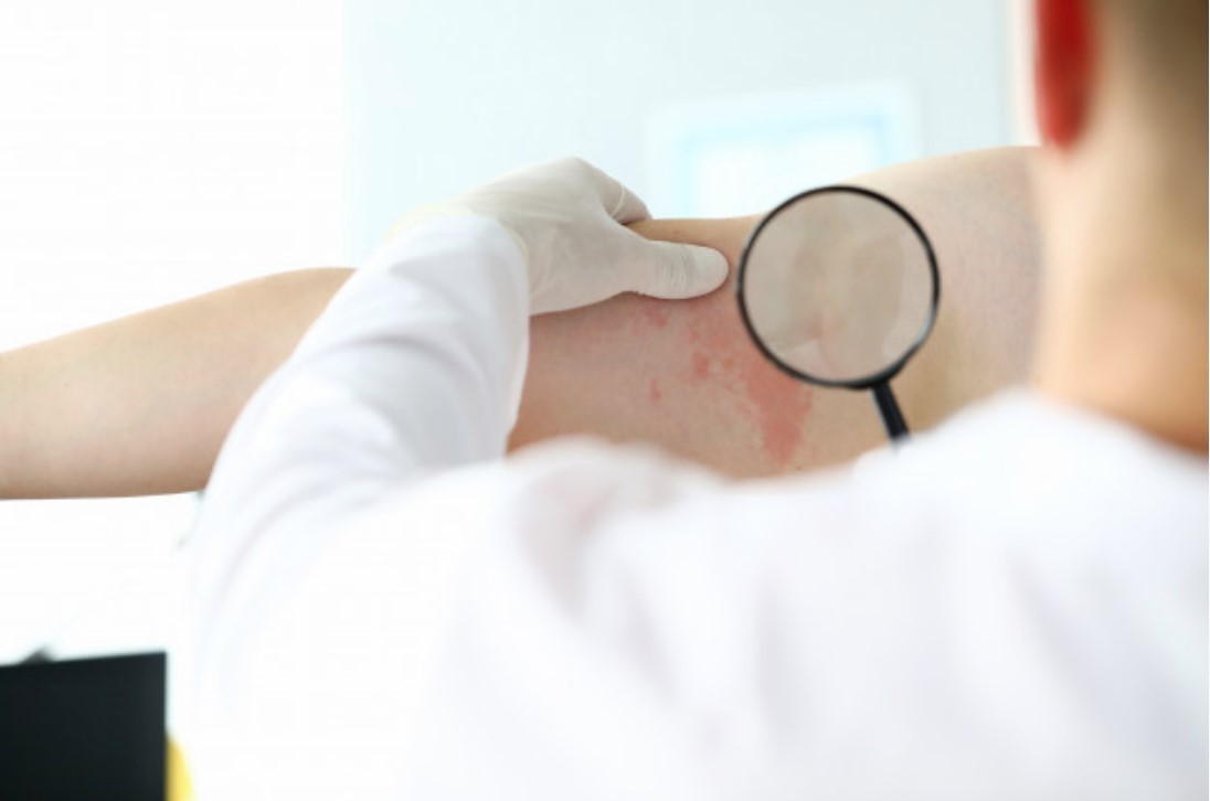 Privatni dermatolog, Rijeka, Ordinacija Manestar