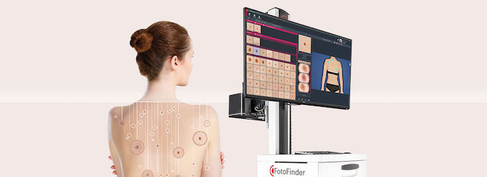 fotofinder